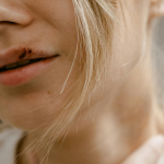 a person with the broken lips, following a violent crime